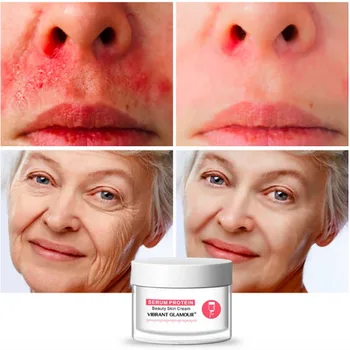 

Serum Protein Melasma Remover Face Cream Anti Aging Freckles Anti Blemish Facial Cream Soins Visage Crema Viso Skincare Products