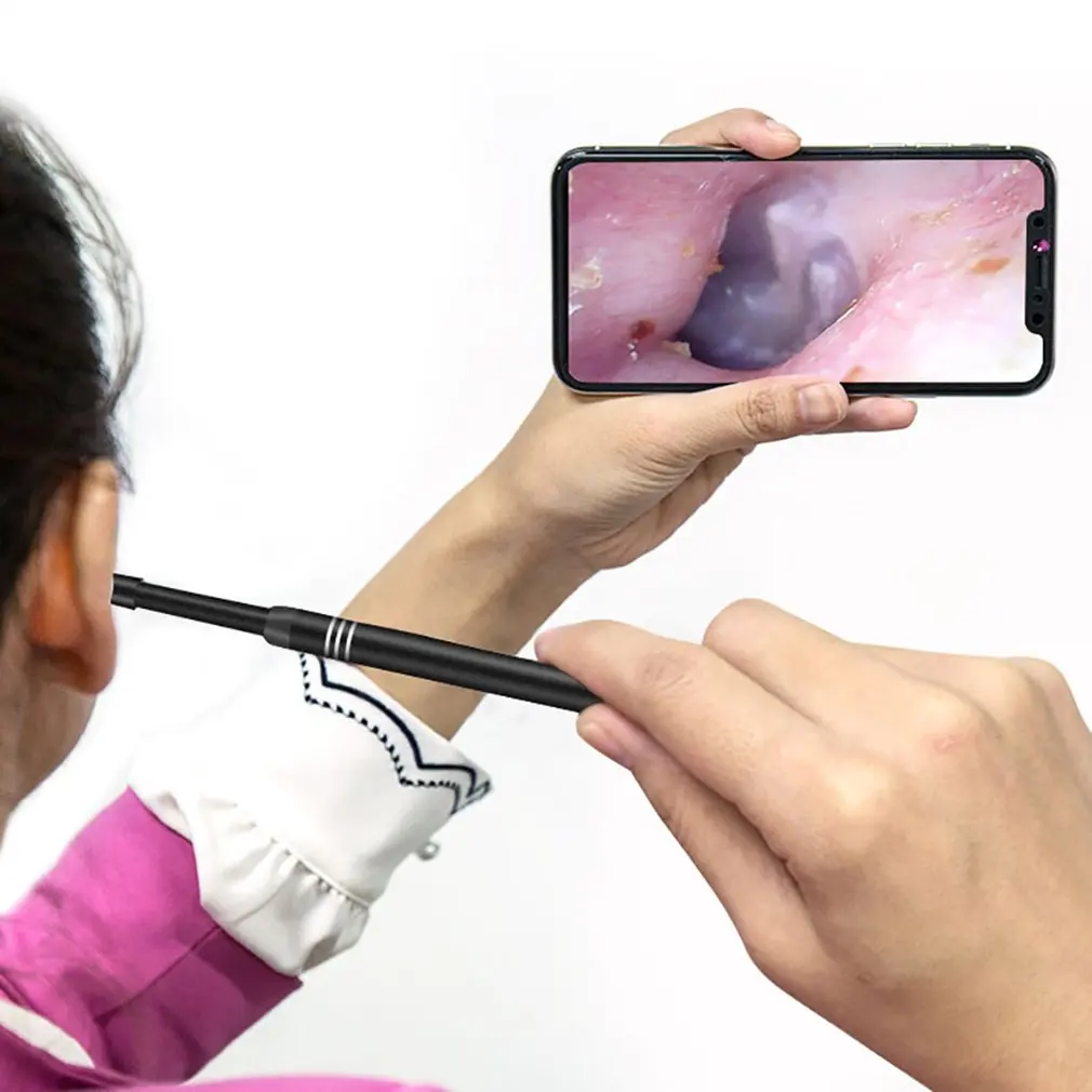 Микрокамера для ухо. Эндоскоп с камерой ухо. Камера ушки. Visual ear spoon. Камера для чистки ушей.
