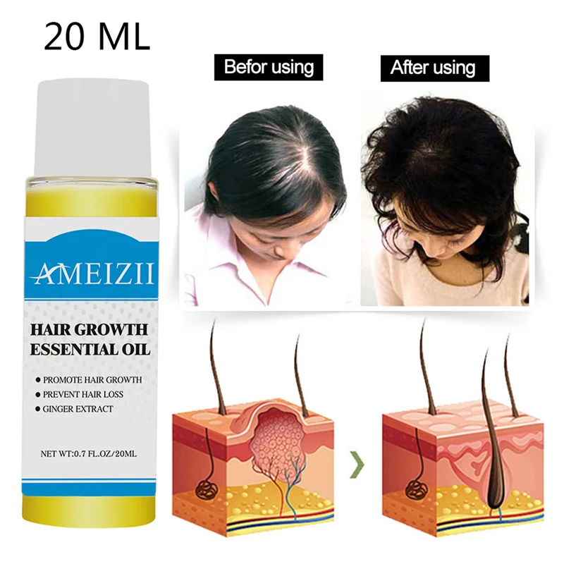 Hair Growth Essence Hair Loss Liquid Ginger Extract Hair Tonic Fast Sunburst Hair Growth Essence Original Authentic 100%