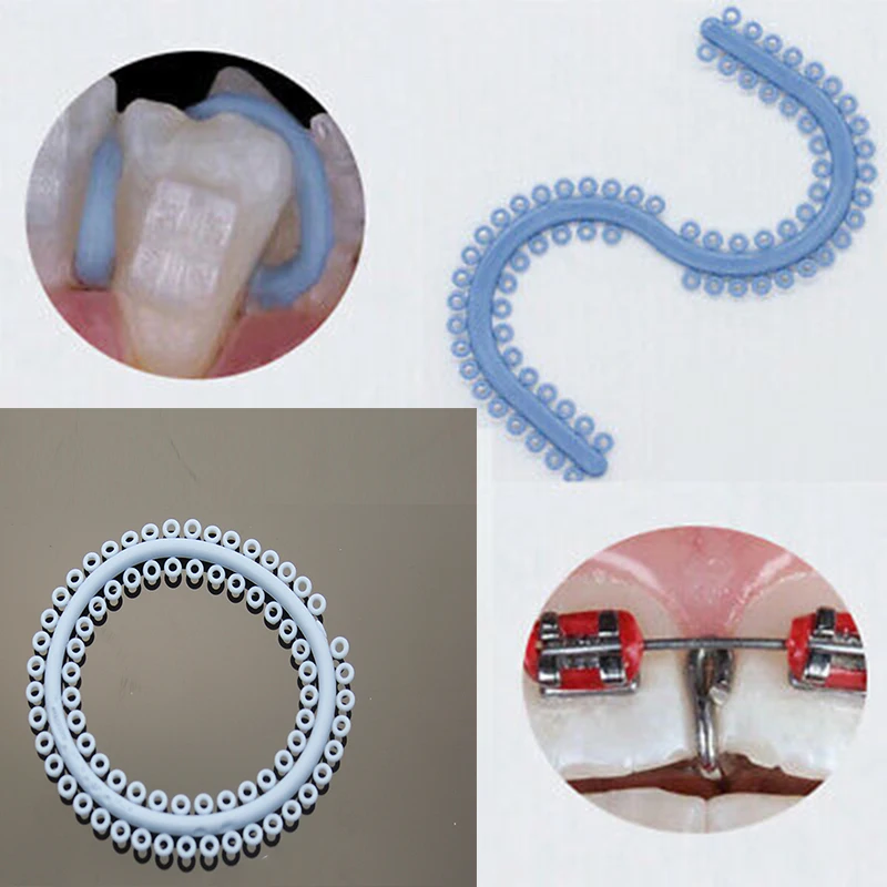 

700Pcs/Pack Dental Orthodontic Elastic Separate Ligature Ties Separator Circle Rubber Ring Blue S/O Type Dentistry Oral Material