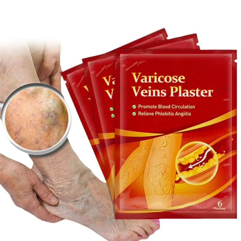 6PCS Varicose Veins Stickers Promoting Blood Circulation Vein Healing Patch Medical Skin Care | Красота и здоровье