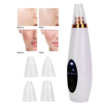 

Skin Vacuum Rechargeable Household Electric Blackhead Removal Suction Instrument Face Pore Acne Cleaner Black Head Remover Tool