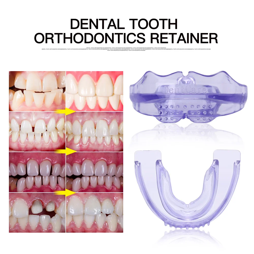 Зубные Брекеты стоматологические ортопедические инструменты для выравнивания зубов отбеливание зубов ортодонтия невидимые брекеты