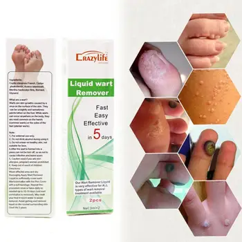 

3ml*2pc Skin Tag Remover Pen 12 hours Tu kill Medical Removal kill Remover Corn Genital Mole Foot & Tu Remover Tag Skin War Y8F9