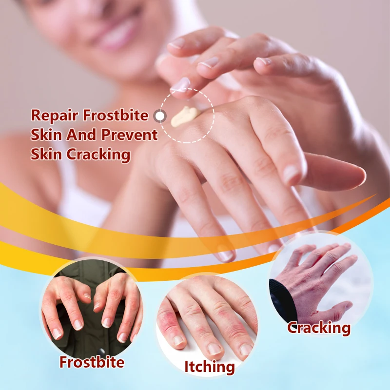 Sumifun 2Pcs Frostbite Ointment Herbal Repair Cream Anti-Drying Chapped Nourish Moisturize Skin Care Chinese Hand Foot Crack Oil