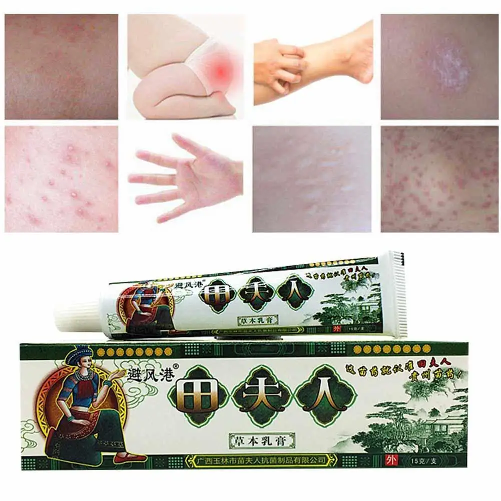 Антибактериальные экзема крем от псориаза лечения дерматит Eczematoid зуд псориаз крем для кожи здравоохранения