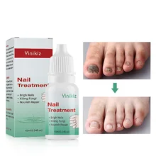 Гель для удаления грибка для ногтей, для ухода за ногами, для ухода за ногтями