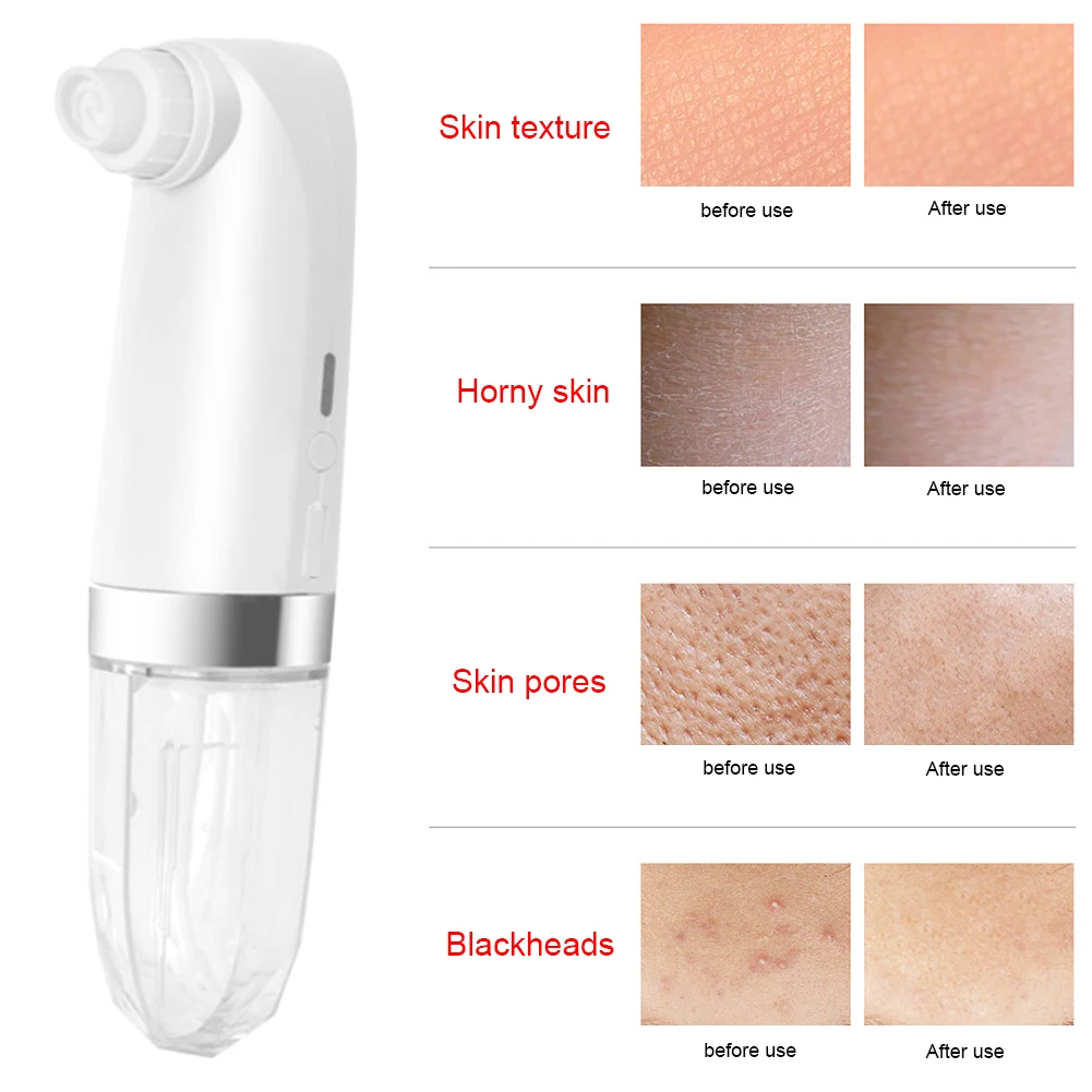 

Original Cordless Electric Blackhead Remover USB Rechargeable Pore Vacuum Cleaner Water Cycling 6 Probe 3 Suction