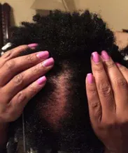 Cuidado del cabello para el crecimiento del cabello aceites esenciales esencia Original auténtico 100% pérdida de cabello líquido salud belleza suero denso para el crecimiento del cabello