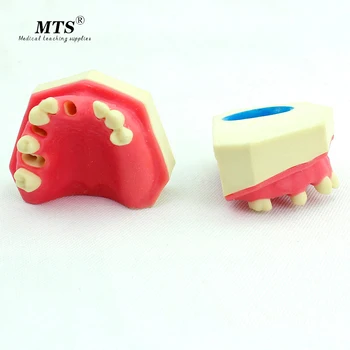 

Dental Model Oral Implantology Maxillary Teeth Bone Maxillary Sinus Dentition Implant Implant Dentist Anatomical Model