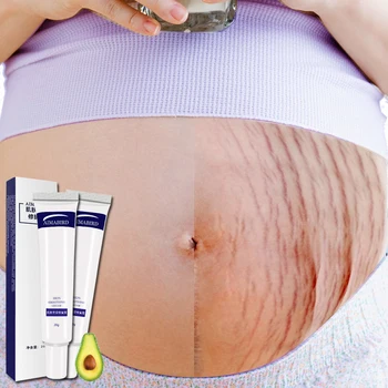preço Creme De Pele Suave Rugas De Gordura Remoção Da Gravidez Para Reparação Da Pele Maternidade Creme Do Corpo Marca De Estiramento Da Pele Macia Cremes De Remoção Da Cicatriz