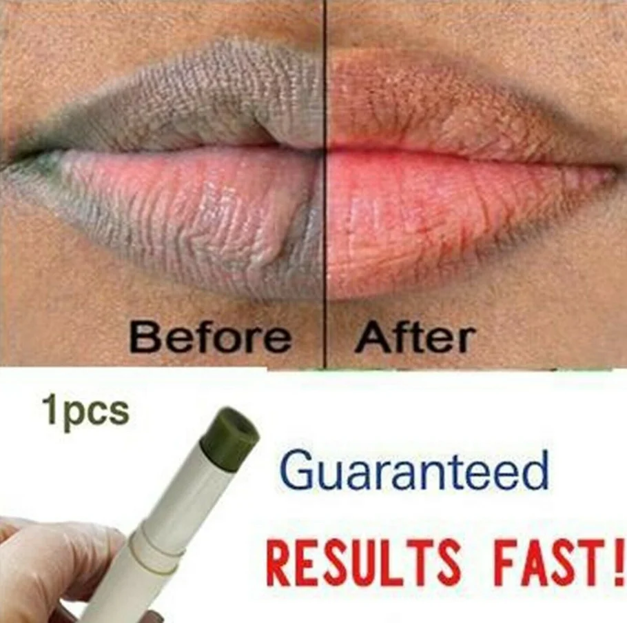 Lips Pink Fresh Fast Lightening Bleaching Lip Balm Treatment Remove Dark Lips lip balm