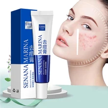 Crème efficace pour l'élimination de l'acné, traitement de la décoloration, taches d'acné, contrôle du sébum, rétrécissement des Pores, blanchissante, hydratante, soins pour la peau