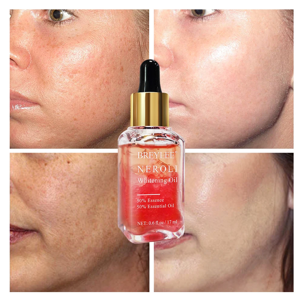 BREYLEE Neroli Whitening Essential Oils Fade Dark Spots Remove Face Freckle Brighten Skin Facial Serum Moisturizer Essence Oil (2)