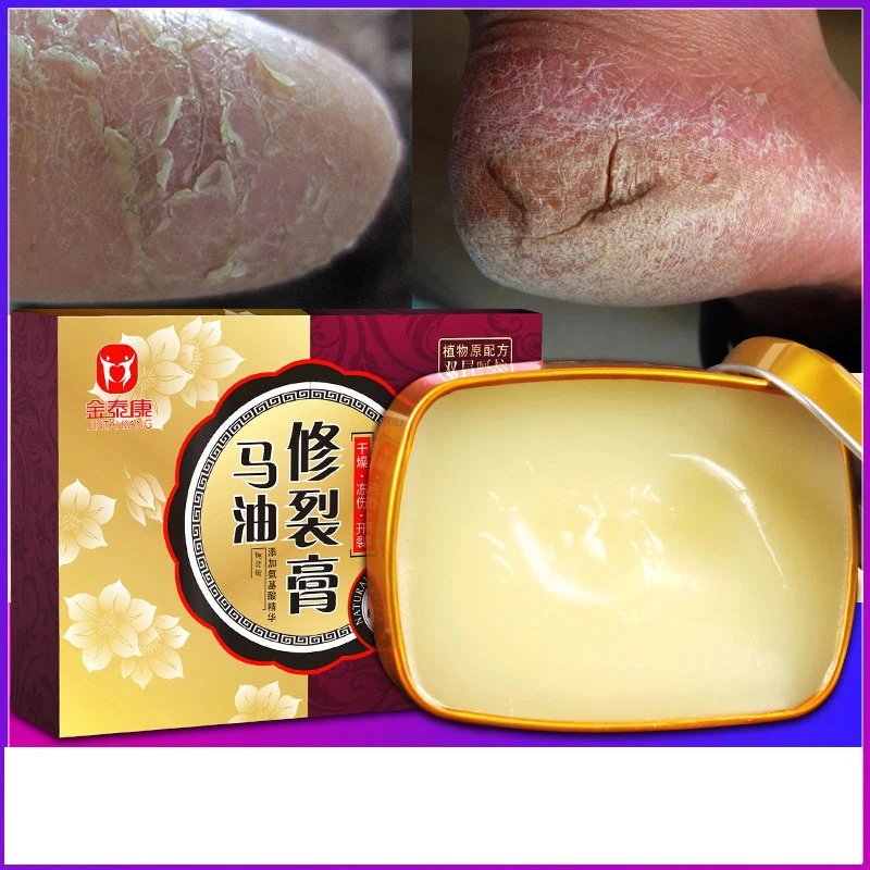 

Horse Ointment Hand Cream Anti-Cracking Cracking Frostbite Clearing Moisturizing Moisturizing Serpent Oil Cream 2 Types choose