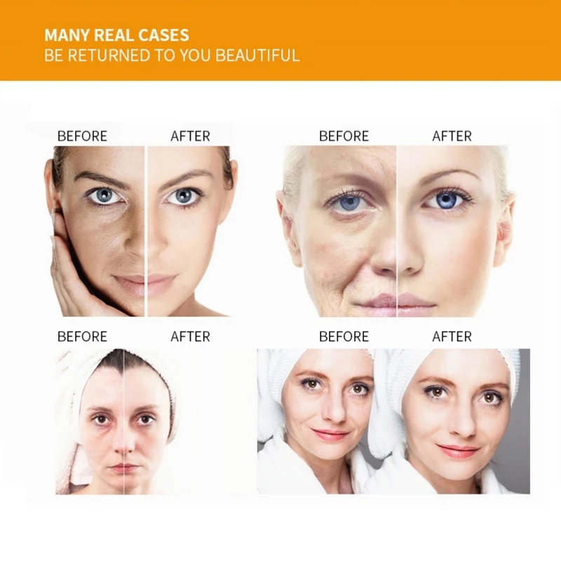 Natural Vitamin C VC Serum Brightening Moisturizing Anti-Aging Anti-wrinkle Skin Care Essential Oils Face Care Serum Beauty Natural Vitamin C VC Serum Brightening Moisturizing Anti-Aging Anti-wrinkle Skin Care Essential Oils Face Care Serum Beauty