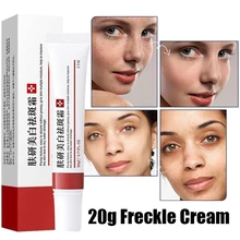 20g Effective Whitening Freckle Cream Remove Acne Dark Spot Fade Pigmentation Melasma Brighten Anti Freckle Cream Face Skin Care
