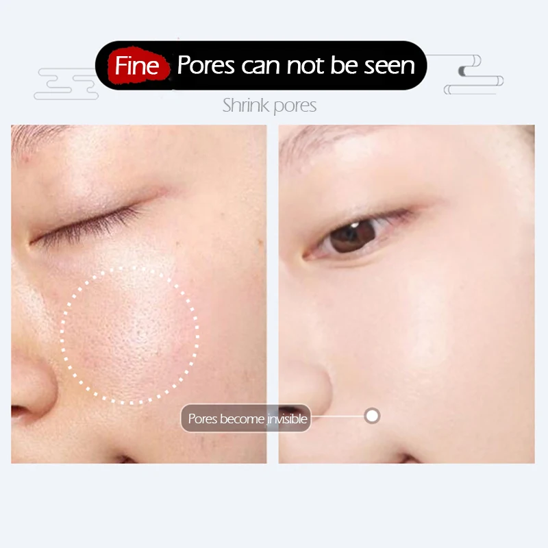 niacinamide on pores