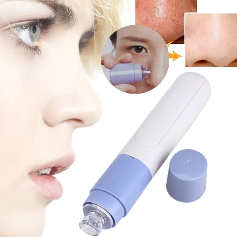 Mini Electric Facial Pore Blackhead Removers Skin Care Tool Cleanser Vacuum Face Dirt Suck Up Acne 1 Mini Electric Facial Pore Blackhead Removers Skin Care Tool Cleanser Vacuum Face Dirt Suck Up Acne 4