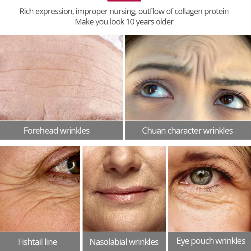 Увлажняющий крем для лица с авокадо от морщин и прыщей увлажняющий ухода за кожей