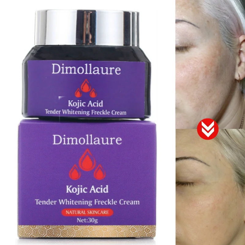 Dimollaure Kojic кислота отбеливающий крем для лица ретинол пигмент меланин удаление