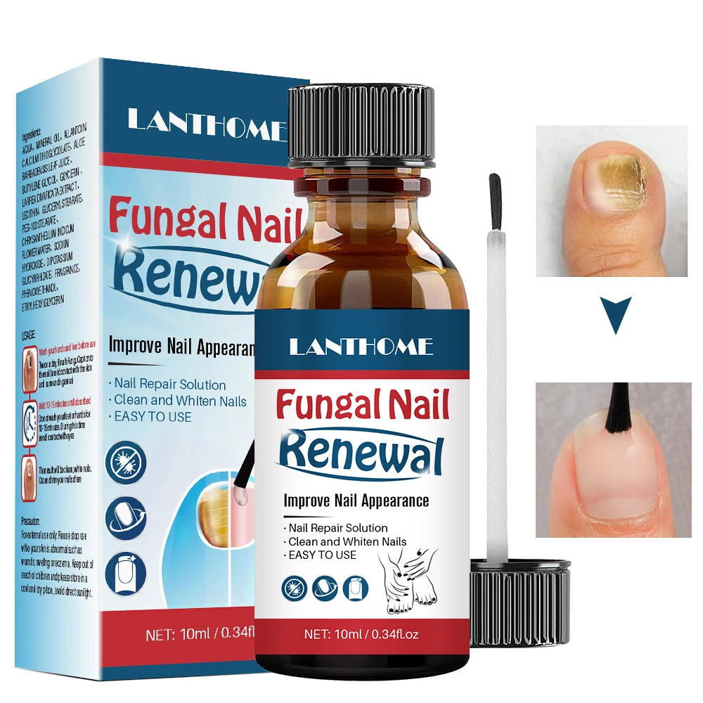 Lanthome Fungal Nail Renewal Anti Fungus Nails Solution Clean Whiten