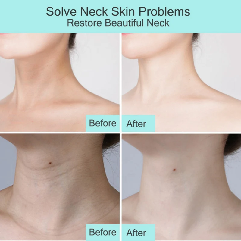 Neck Firming Rejuvenation Cream Anti-wrinkle Firming Skin Whitening Moisturizing Neck Serum Beauty Neck Care