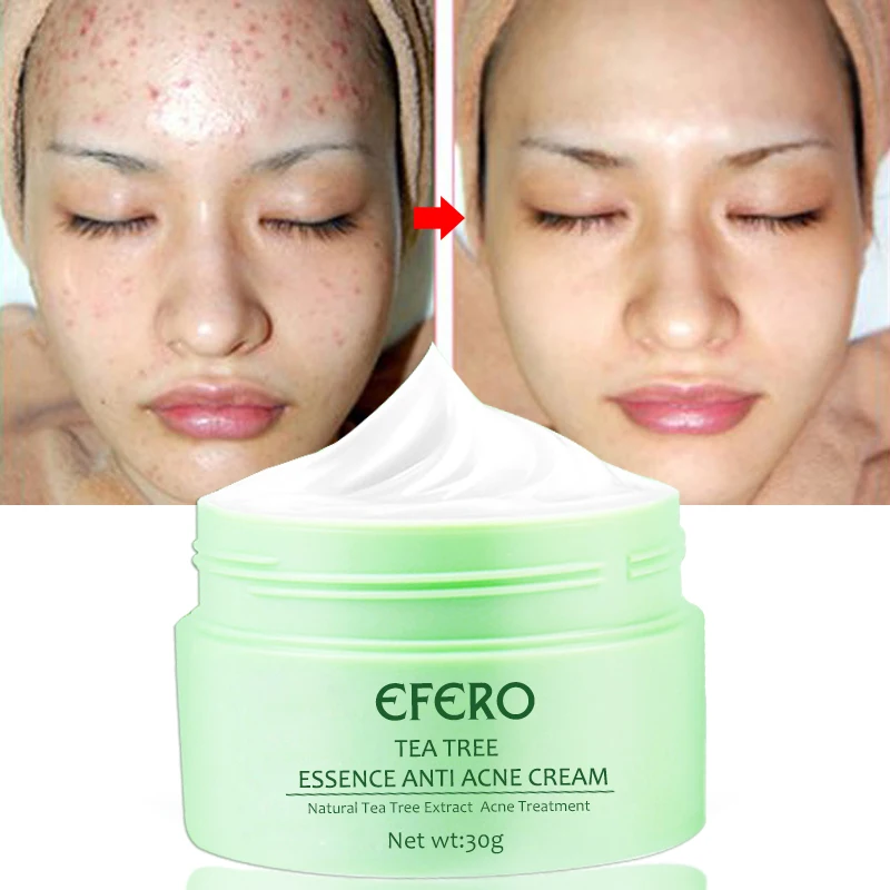 EFERO крем для лица против акне, против старения, против морщин, крем для лица, отбеливающий уход за кожей, чай, дерево, удаление шрамов, крем для лица