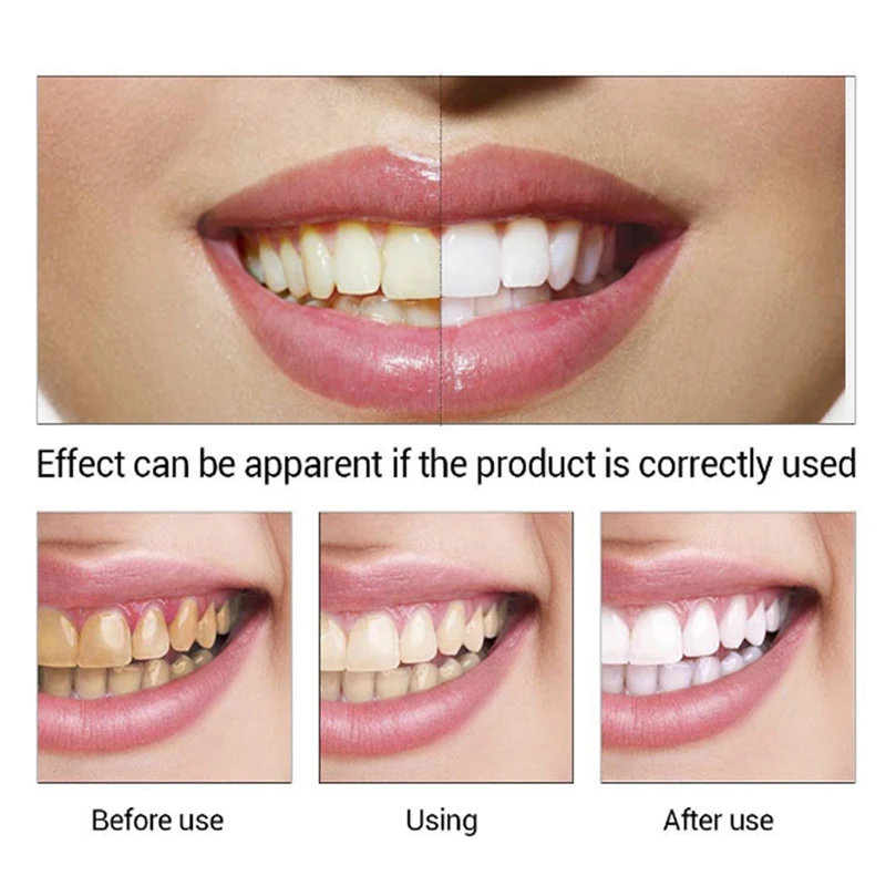 Teeth Whitening Essence Powder Gel Oral Hygiene Cleaning Serum Effective Removes Plaque Stains Tooth Bleaching Dental Tools