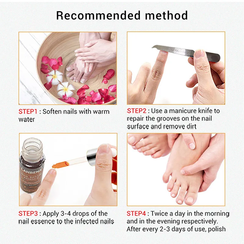 12 мл, восстанавливающая эссенция для ногтей, сыворотка для лечения грибков ногтей, для удаления онихомикоза, для пальцев ног, Питательный Уход за ногами
