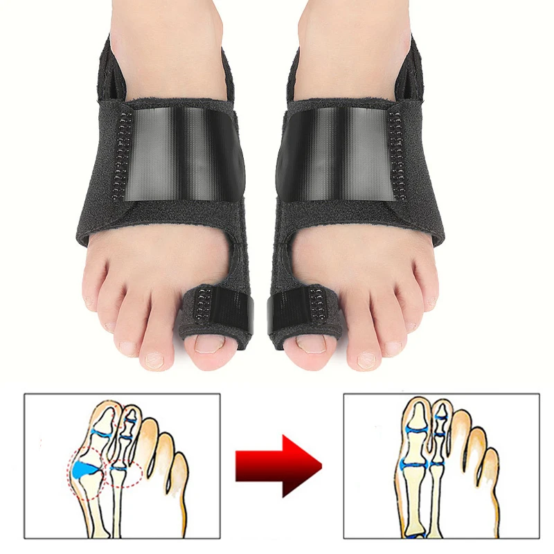 

1Pair Foot Care Bunion Corrector Hallux Valgus Toe Protector Separator Feet Orthopedic Supplies Toe Straightener Splint Pedicure