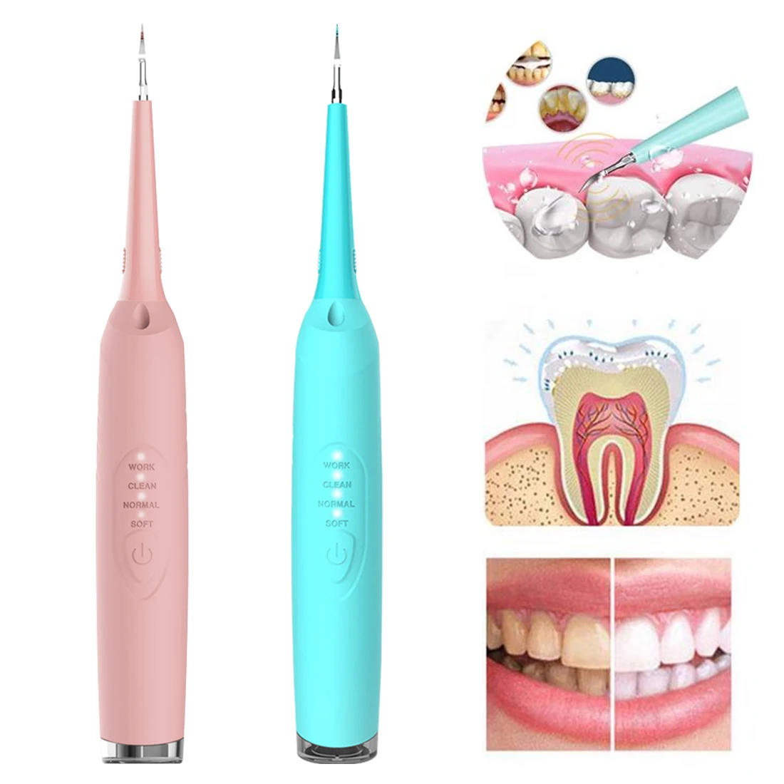 

New Dental Calculus Remover, Electric Portable Oral Irrigation Teeth Whitening Tartar Scraper Health