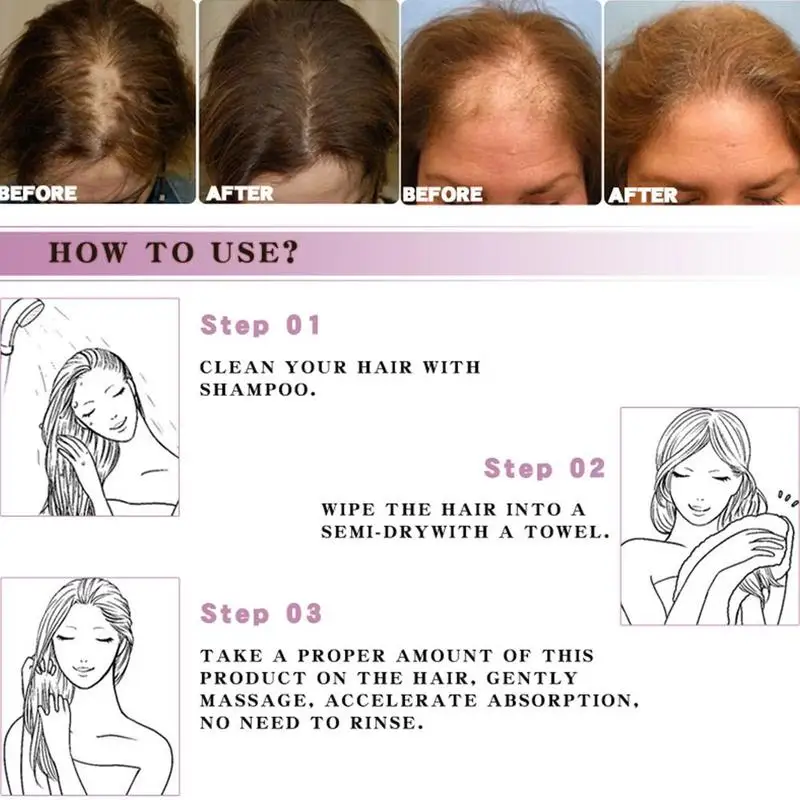 Ginger Hair Care Spray For Hair Care And Protects Damaged Hair Keratin Moisture Hair 130ml Hair Salon Products Scalp Treatments Ginger Hair Care Spray For Hair Care And Protects Damaged Hair Keratin Moisture Hair 130ml Hair Salon Products Scalp Treatments