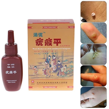 

20ml Removal Warts Tool Warts Removal Treatment Foot Corn Foot Care Tool