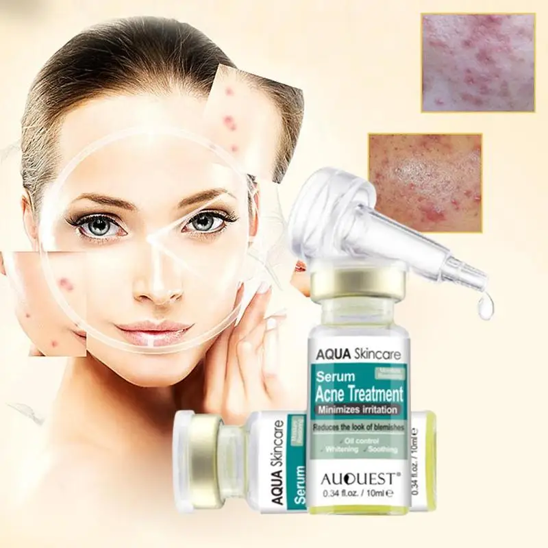10ml Vitamin C Face Serum Natural Serum Liquid Hyaluronic Acid Moisturizng Anti Aging Anti Wrinkle For Skin Care 10ml Vitamin C Face Serum Natural Serum Liquid Hyaluronic Acid Moisturizng Anti Aging Anti Wrinkle For Skin Care