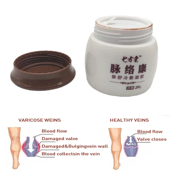 

20G Spider Veins Varicose Treatment Gel Varicose Veins Cure Patch Vasculitis Natural Solution Herbal Patches Health Care Plaster