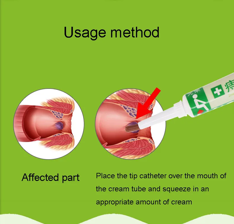 Геморроидная мазь, массажная абсорбция, фрикадель, устранение анального раскола, лечение гематочезией, облегчение обезболивания