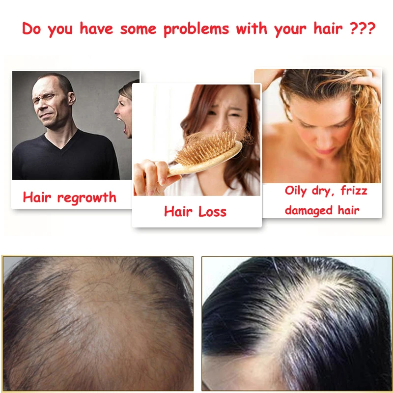 Бэлucc Шампунь для волос рост естественная трава анти офф шампунь уход за