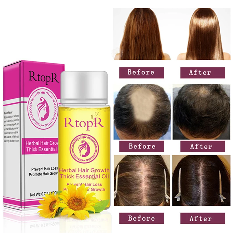 

Herbal Fast Hair Growth Essence Oil Anti Hair Loss Liquid Thick Provide Nutrition Treatment Dryness Repair Damage Hair Root