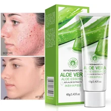 

Aloe Vera Gel Face Cream Moisturizing Anti Inflammation Anti-Acne Shrink Pores Sunburn Repair Soothe Oil Control Brighten 40g
