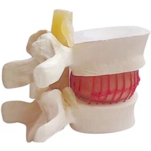 1 шт. анатомический Поясничный диск грыжа поясничного отдела позвоночника модель белого цвета TSH магазин
