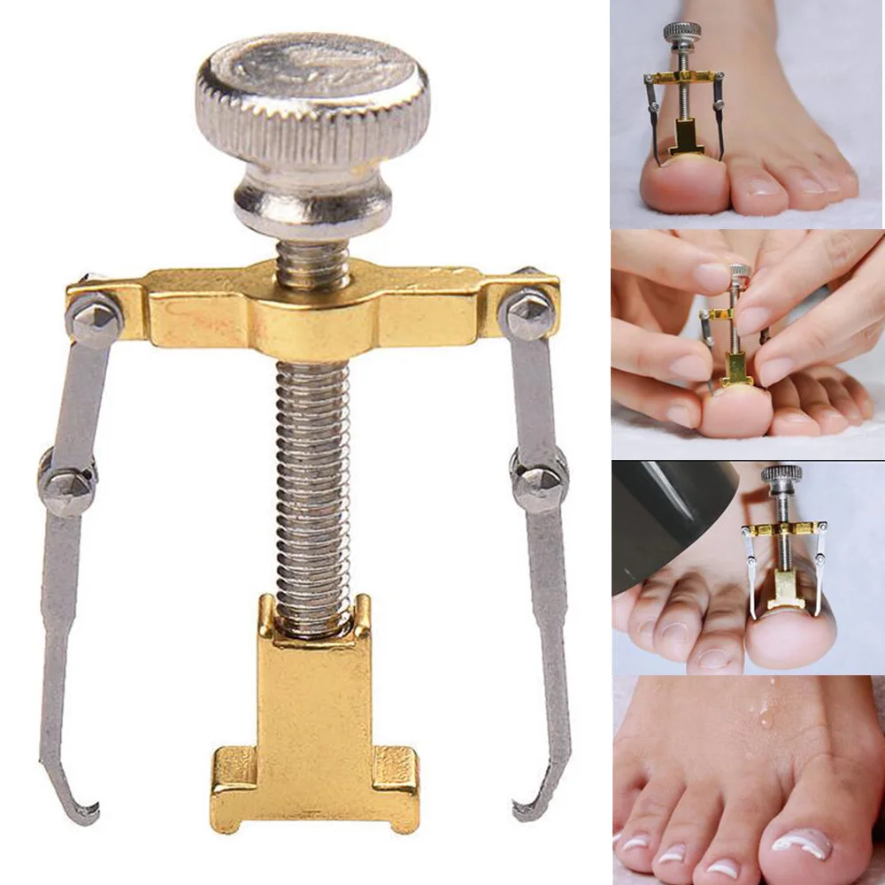 toenail corrector