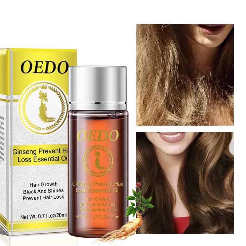 Ginseng Prevent Hair Loss Fast Accelerate Growth Essential Oil Serum Repair Dense Nourishes
