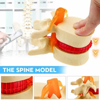 

High Quality Human Lumbar Vertebrae Model Anatomical Medical Props Anatomical Spine Lumbar Disc Herniation Teaching Tool