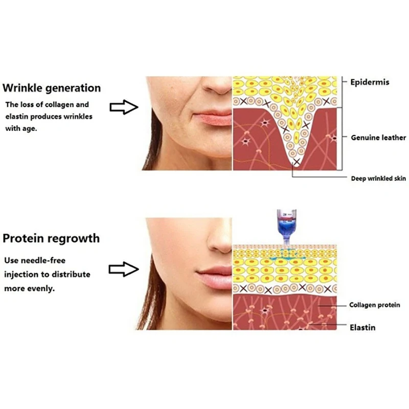 5c40297fdbbefe3b8f729df4-10-large