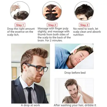 

Blue Lanyi Yi Probiotic Scalp Cleansing Massage Essence Nourishing Scalp Anti-dandruff Itching Soothing Anti-dandruff Scalp B9N4