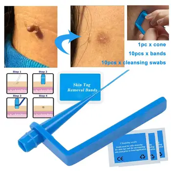 

Micro Band Non Toxic Face Care Mole Wart Tool For Small To Medium Blue Skin Tag Removal Kit With Cleansing Swabs Home Unisex