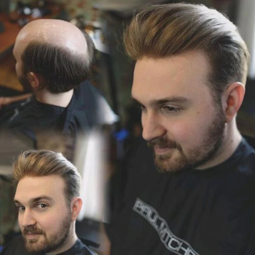 toupee8