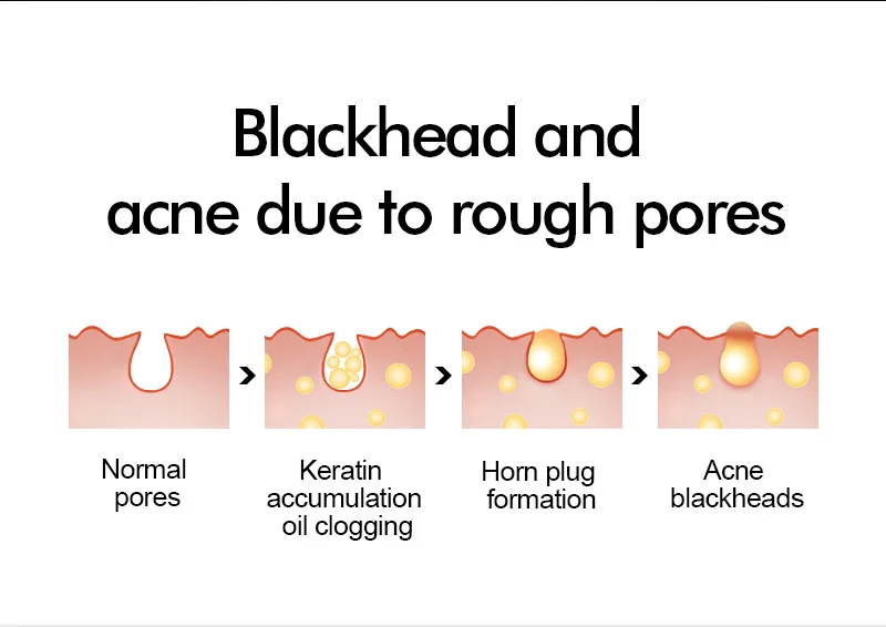 男士乳糖酸精华液详情-水印_03