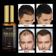 Сыворотка для быстрого роста волос, эфирные масла, эссенция, против потери волос, жидкость для восстановления поврежденных волос, уход за волосами для женщин и мужчин